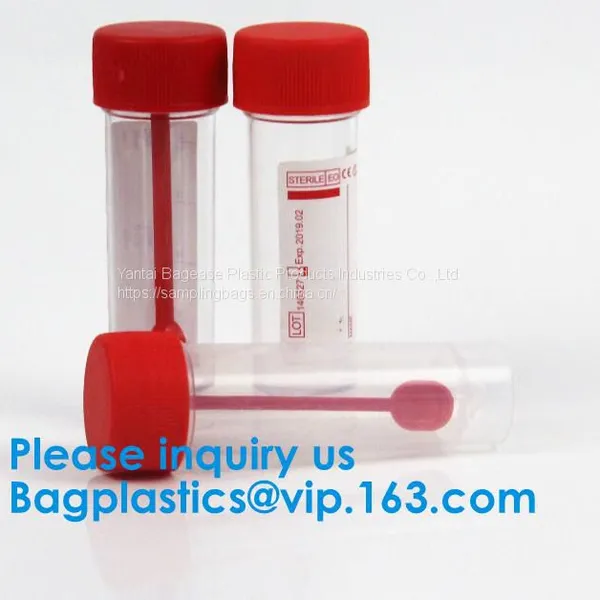 20ml-1000ml Histology Specimen Container Urine Containers, Disposable Medical Consumables Plastic 100ml 120ml Sampling Cup Specimen Container photo-2