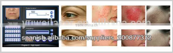Newest Skin Rejuvenation and Wrinkle Removal Fractional rf Machine photo-3