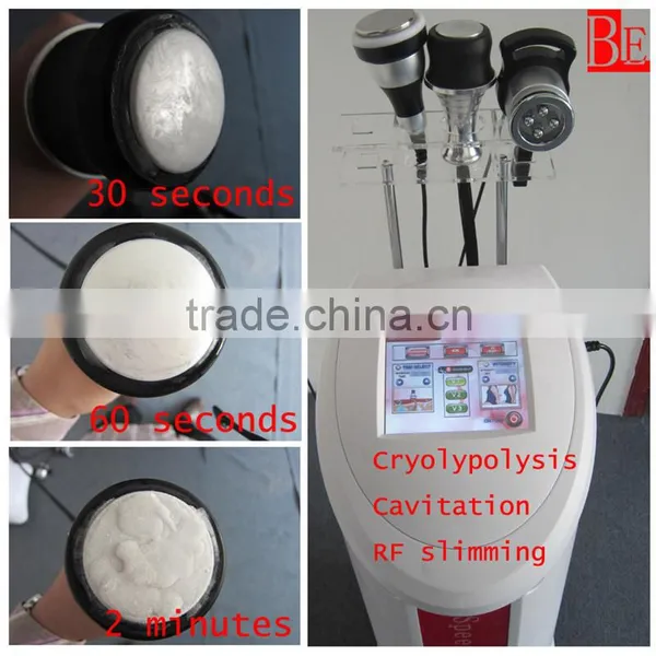 Manufacturer for Cool Tech Fat Freezing Machine photo-2