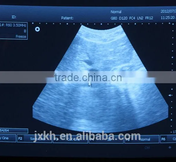 3D Full Digital Portable Ultrasound Scanner With PC Platform photo-6
