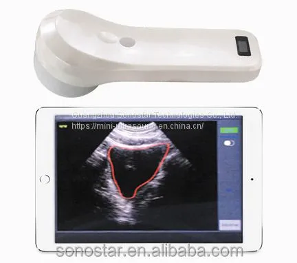 Sonostar Ultrasound 2 in 1 Double Head Color Doppler Convex & Linear Ultrasound Machine Scanner