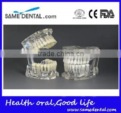 Dental Standard Transparent Dentition Model DEA-46 photo-2