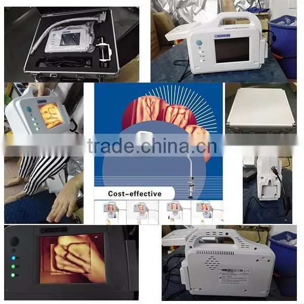 YSVV200 Good Price Top Sale Medical Infrared Vein Viewer photo-4