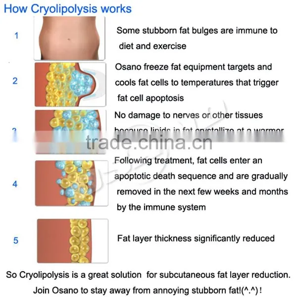 500W Effective Burn Fat Cryolipolysie Body Contouring Machine Fat Reduce photo-6