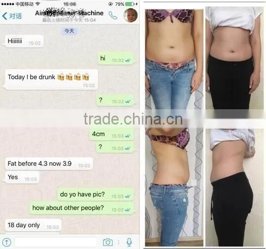 Skin Lifting Bottom Price Cryolipolysis Fat Fat Reduction Freeze Slimming Machine Cool Tech Body Shaping photo-5