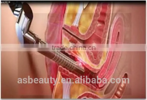 OEM Multifunction Clinical/medical/hospital Laser Vaginal Tightening Machine photo-5