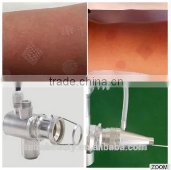 Mole Removal The Popular Co2 Fractional Laser Therapy Warts Vaginal Rejuvenation Removal Machine For Skin Resurfacing Fractional Laser Wrinkle Removal photo-3