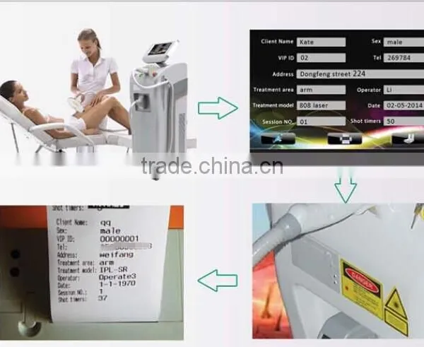Huamei Diode Pigmented Hair Laser Hair Removal Home photo-5