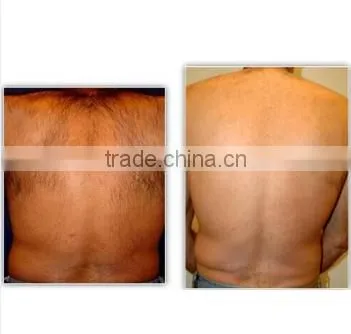 HOT In World Portable Ipl Hair Removal/hair /permanent Hair Removal/ With CE+manufactory for Clinic , Family Adn Beauty Spa photo-6