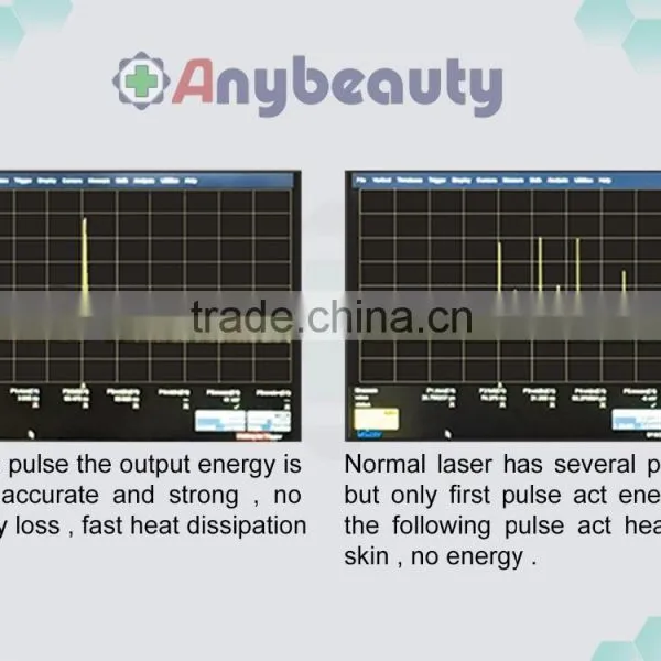 Carbon Peeling Treatment/tatoo Removal Machine Carbon Peeling Treatment photo-4