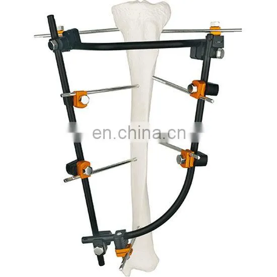 Competitive Price Orhtopedic External Fixator for Tibia Surgery photo-2