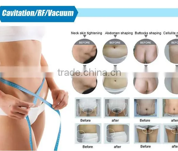 CE Approved 5 in 1 Weight Loss Mono Polar Ultrasound Slimming Skin Tightening photo-6
