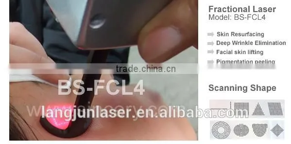 Tattoo /lip Line Removal CE Certificates Acne Treating And Skin Rejuvenation Fractional Co2 Laser Equipment Birth Mark Removal photo-4