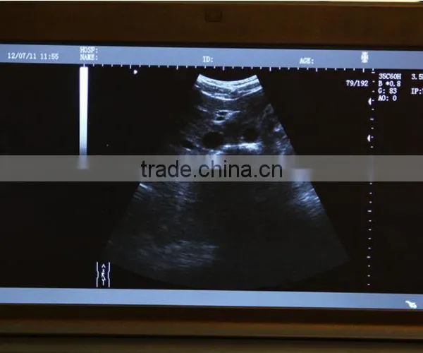 Hot Sale Black Color 10.1-inch High-resolution TFT LCD Portable pc Ultrasound Machine for Scan photo-2