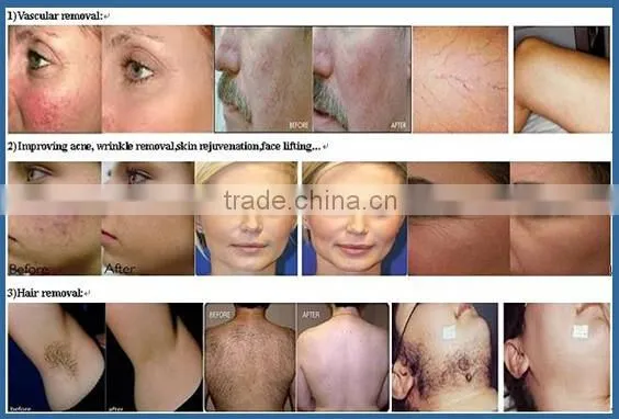 Weifang KM KM-E-600C+ 9 in 1 Multifunction Beauty Machine for Slimming photo-6