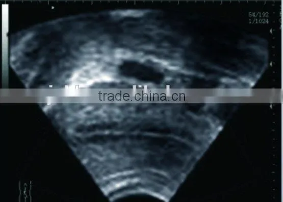 Notebook Ultrasound Scanner RUS-9000F With 3.5Mhz Convex Probe and 7.5Mhz Linear Probe Diagnosis Machine photo-4