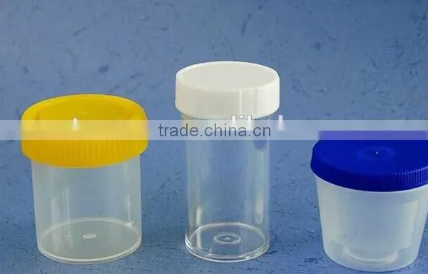 Disposable Urine Cup (Specimen Container)