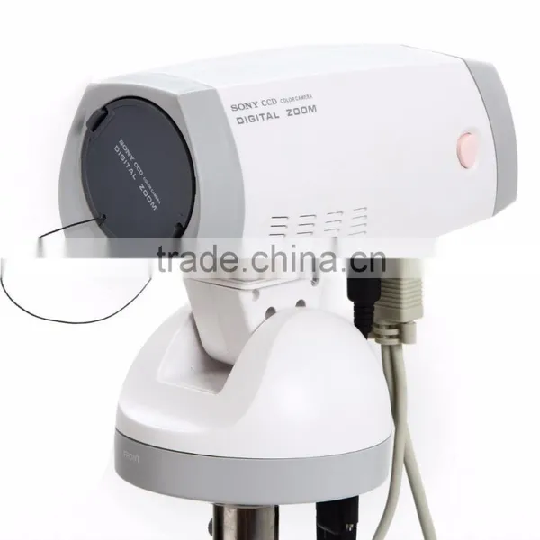 18 Months Warranty Electronic Vagina Video Colposcope for Clinical Detection photo-2