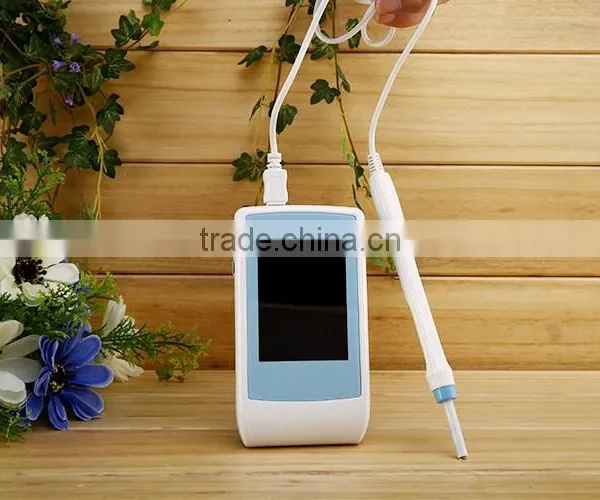 China Low Price1.3MP Best Dental Cameras With Monitor for 2016 photo-5