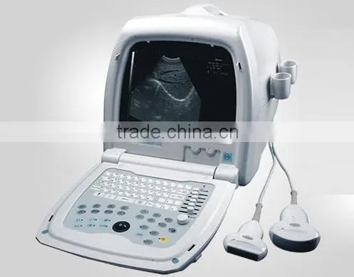Cheap Trolley Portable Ultrasound Machine Price photo-3