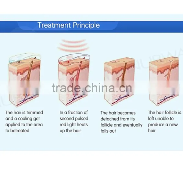 1800W Strong Power!!! 808nm Diode Laser Hair Removal Beard Machine /diode Laser Hair Device Back / Whisker photo-5