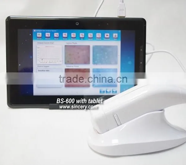 2014 New Designed Handheld Skin Analyze Camera photo-6