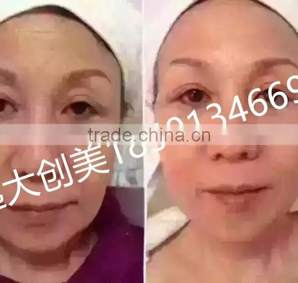 New Products 2016 Technology Portable Face Lift Health and Beauty photo-6