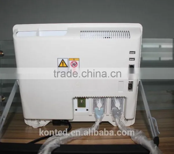 Full Digital Medical Ultrasound Scanner With Ce Marked photo-4