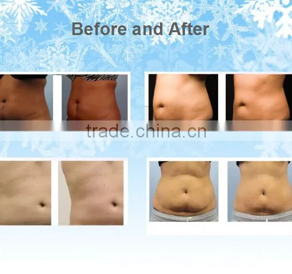 Fat Reduction TaiBo Beauty SUPER Promotion !!!Good Effect Cryolipolysis Lose Weight Machine/laser Lose Weight(809nm Laser Led) 500W photo-6