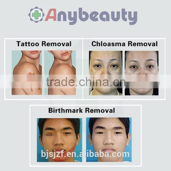 2016 High Quality nd Yag Laser Tattoo Removal Laser Picosure for Tattoo Removal photo-5