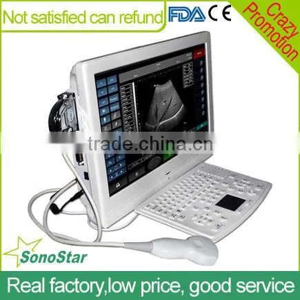 Sonostar Good Quality Handheld Portable Vet Ultrasound Scanner Pig Veterinary Ultrasound V8