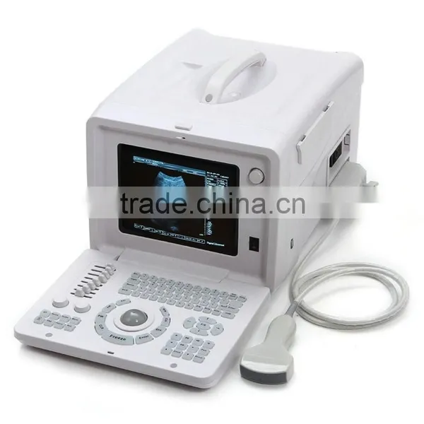 CE Approved Laptop/Portable Ultrasound Scanner With 3.5Mhz Multi-frequency Convex Probe RUS-6000D photo-2
