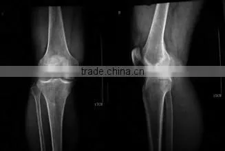Medical X-ray Film Agfa Medical Dry Film for X-ray Machine Agfa Kodak Film photo-5