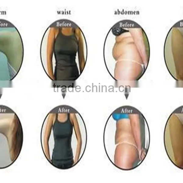 Supersonic Fat Reduction Liposonix HIFU Best Nubway Slimming Machine/ Hifushape for Body Sliming photo-6