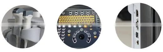 Medical Equipment 18 Months Warranty Ultrasound Machine Color Doppler With Trolley photo-5