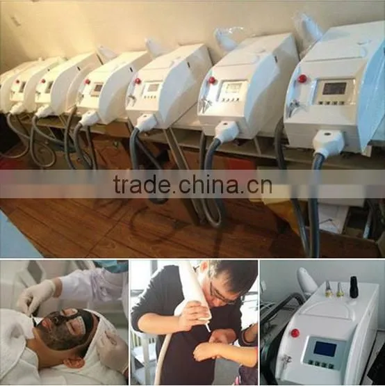 ND YAG Q-Switch Laser Best Tattoo ND Yag Laser Tattoo Removal 1064nm and 532nm Laser nd Yag Laser/ Medical photo-5