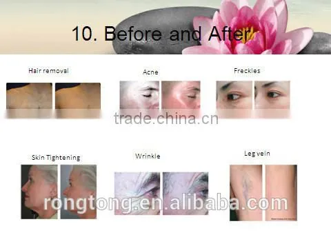 2016 Hot Selling Professional RF Beauty Machine Korean Beauty Equipment photo-5