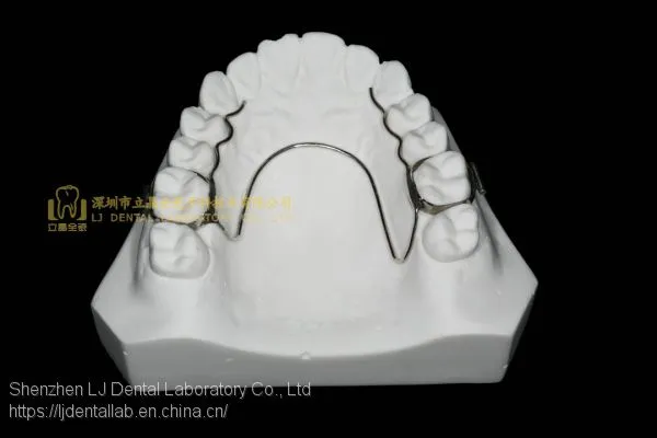 Space Expanders, Nance Appliance, Helix Appliance, Pendulum Appliance, ﻿﻿﻿﻿Porter Appliance, Fixed Lingual Expander, Sagittal Screw Appliance, Hyrax Rapid Palatal Expander, Orthodontic Retainers, Dental Orthodontic Appliance, Laboratoire Dentaire, Dentall photo-4