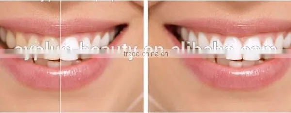 AYJ-J003A Laser Teeth Whitening Machine /teeth Whitening Laser photo-6