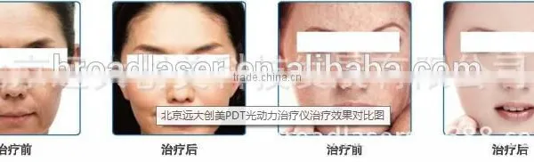 Skin Lifting High Quality Hot Selling Pdt Led Infrared Therapy Systems Led Lamp For Sewing Machine Anti-aging photo-6