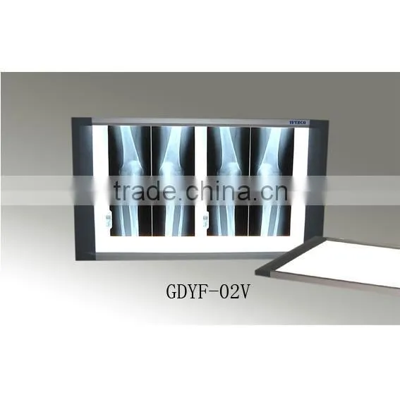 X Ray Film Viewer