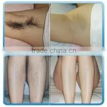 2016 Hot Sale 808nm Diode Laser Hair Removal Machine/hair Removal Speed 808 photo-5
