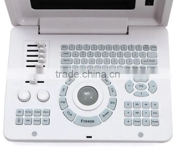 CE Approved Laptop/Portable Ultrasound Scanner With 3.5Mhz Multi-frequency Convex Probe RUS-6000D photo-3