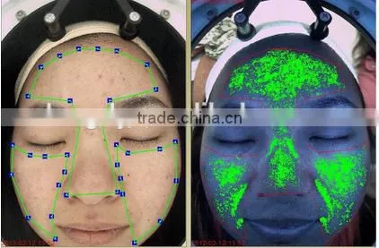 Skin Analyzer Machine Allergy Testing Analyser Machine photo-5