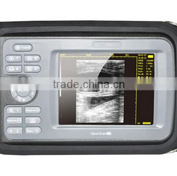 HandScan H8 Portable/palm Handheld Ultrasonic/ Ultrasound Machine Lower Price/medical Equipment photo-2