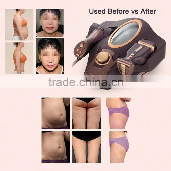 2016 Multifunctional Manufacturcter Wrinkle Machine Vitation Weight Loss Machine photo-5