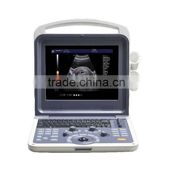 2016 New Laoptap 3d/4d Ultrasound Color Doppler Syatem CE