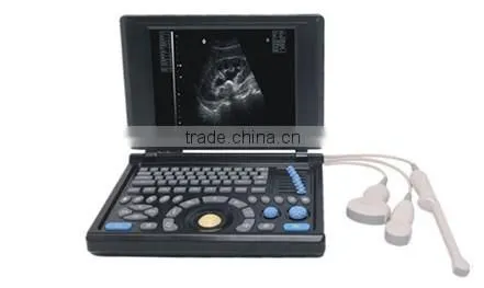 Big Sale PC Platform 10.4 Inch Laptop Ultrasound Scanner With 3.5Mhz Convex Probe CE ISO Certified photo-5