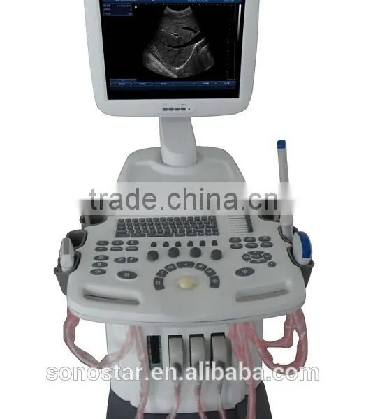 SS-600 Trolley Ultrasound Scanner photo-3