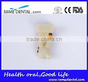 Dental Model School Teaching Dental Eduction Assitant No. DEA-15 4 Times Integrated Pathology Model photo-4